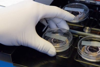 Đông lạnh trứng -  Xu hướng mới của phụ nữ độc thân Anh